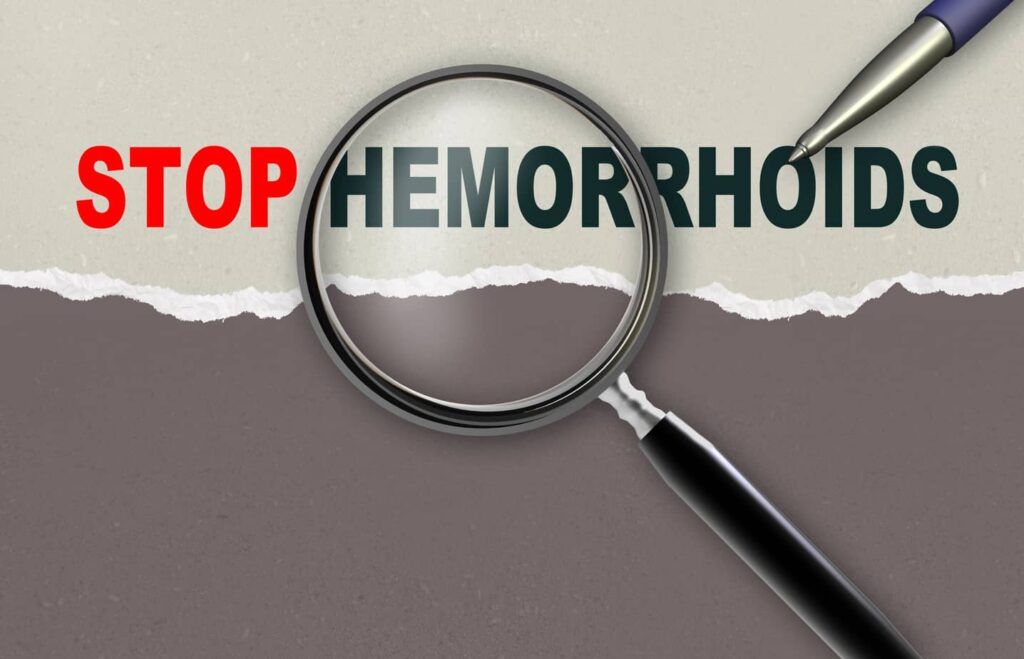 Hemorrhoid treatment natural. How to solve an iching pain without using medication or chemicals