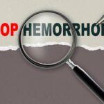 Hemorrhoid treatment natural